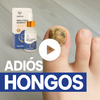 [2X1] NAIL FUNGUS2® |ELIMINA LOS HONGOS DE LAS UÑAS EN DÍAS Y EVITA QUE APEREZCAN PARA SIEMPRE